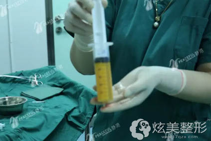 静港整形医生吸脂抽出的脂肪 静港整形医生吸脂抽出的脂肪
