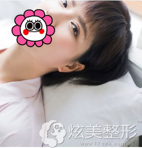 术后90天北京凯润婷双眼皮案例效果 术后90天北京凯润婷双眼皮案例效果