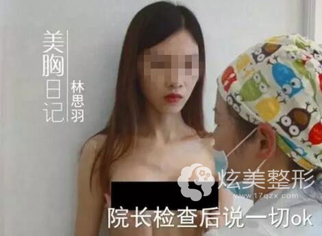 南宁华美隆胸第三天的时候就完全没感觉了 南宁华美隆胸第三天的时候就完全没感觉了