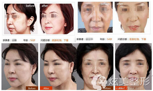 在常州美贝尔整形医院做<span style= 在常州美贝尔整形医院做<span span=
