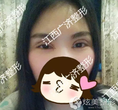 ����8�����ϲ��������˫��Ƥ����