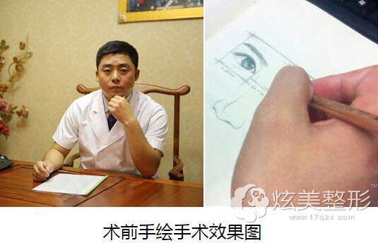 张高贵医生术前手绘效果图 张高贵医生术前手绘效果图