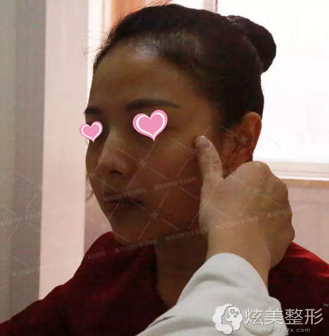 在石家庄雅芳亚整形面诊 在石家庄雅芳亚整形面诊