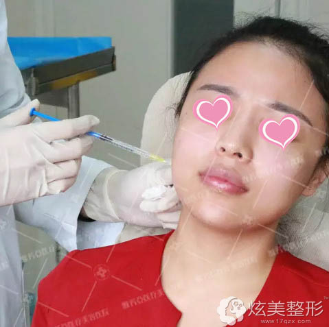 石家庄雅芳亚医生为我注射瘦脸 石家庄雅芳亚医生为我注射瘦脸