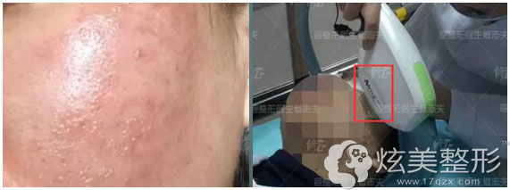 ���ټ�������ɫ�ض�ӡ