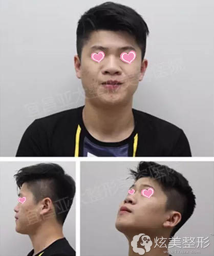 ��ǰ����������ͷ��ƽ