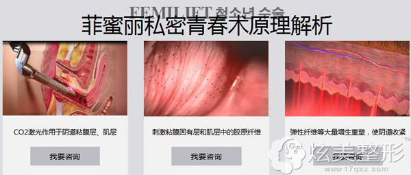 杭州艺星菲蜜丽私密青春术原理图 杭州艺星菲蜜丽私密青春术原理图