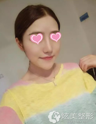 ����15�����Ǳ��̱�