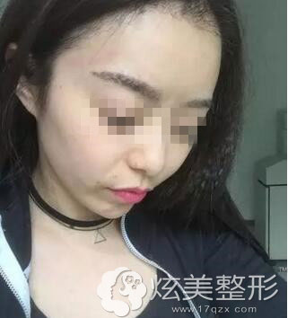 �人��ԭҽԺ��������ֲ2����Ч��