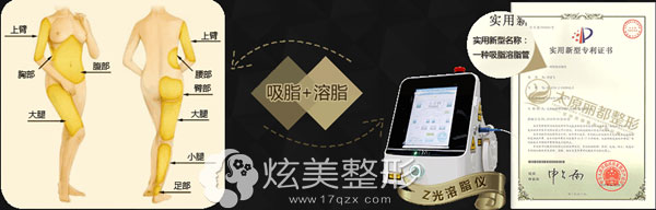 太原丽都整形吸脂和溶脂 太原丽都整形吸脂和溶脂