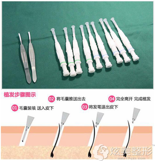 �Ϻ���������רҵֲ�������Լ�ֲ��ԭ��