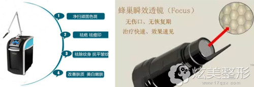 皮秒祛斑原理 皮秒祛斑原理