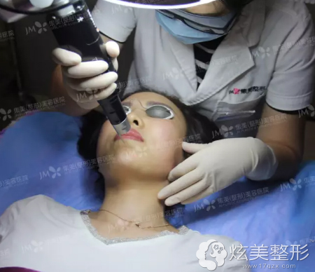 针对不同的斑点用不同型号的治疗头 针对不同的斑点用不同型号的治疗头
