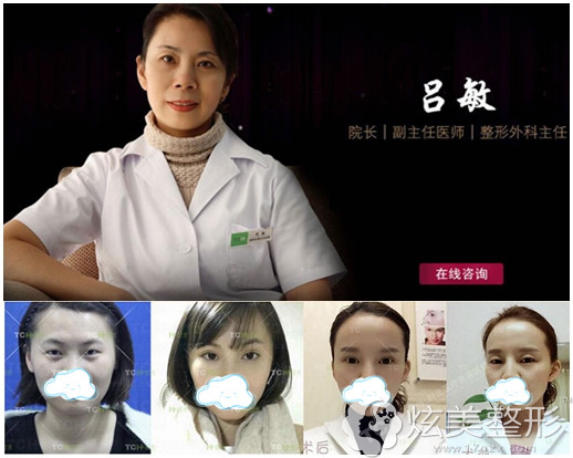 杭州时光双眼皮医生吕敏 杭州时光双眼皮医生吕敏