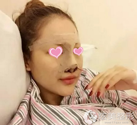 ����3���ҪסԺ�۲�