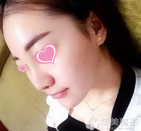 ����7����ӻָ����