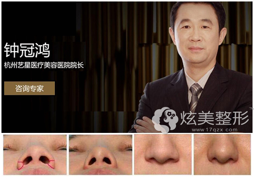 �������Ǳ�����Сҽ���Ƽ��ӹں�