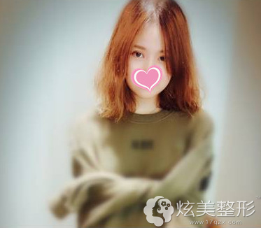术后7天眼睛还是肿胀的 术后7天眼睛还是肿胀的