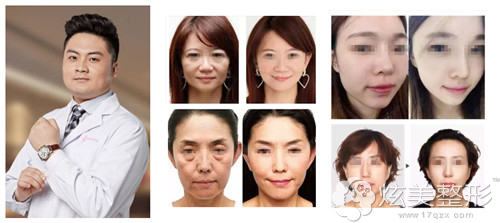 擅长线雕提升的马鞍山福华整形医生袁抒怀 擅长线雕提升的马鞍山福华整形医生袁抒怀