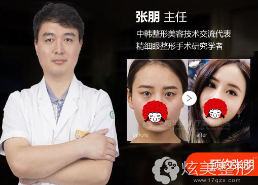 上海华美双眼皮医生推荐张朋 上海华美双眼皮医生推荐张朋