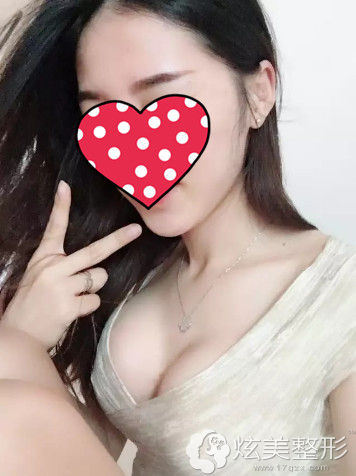 ���м���¡��40���ӵ����Ȼ�����ز�