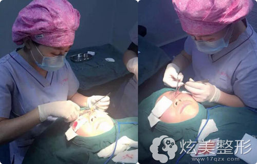 郑州瑞亚贺洁院长给又小又肉的眯缝眼做眼综合手术全过程整形案例