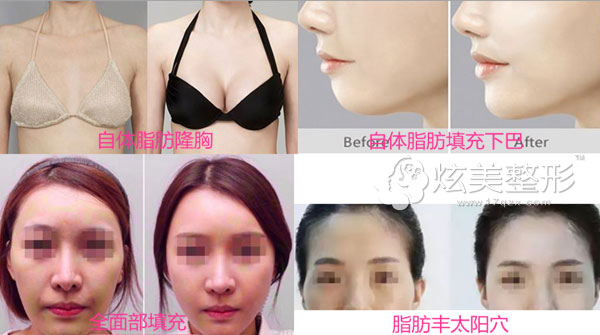 ������˹��ŵ֬��������λզ�շ�?Ч����ϲ���ܳ����
