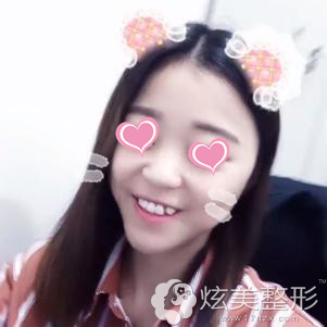 ��ע����������Ч��