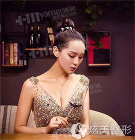 肖征刚院长隆胸案例 肖征刚院长隆胸案例