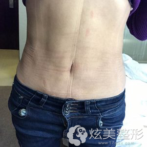 脱掉塑身衣腰部曲线很明显 脱掉塑身衣腰部曲线很明显