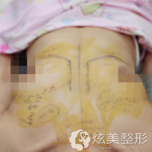 做好术前一切准备工作 做好术前一切准备工作
