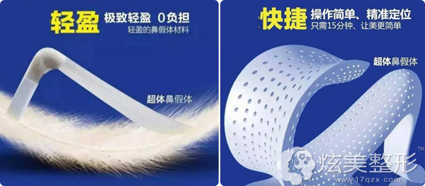 超体隆鼻优势 超体隆鼻优势