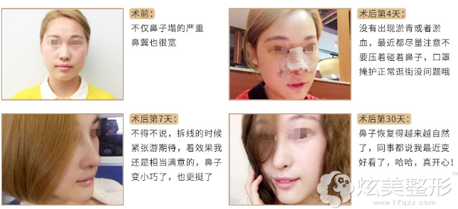 ����ޱ���RH��Ʒ�ۺ����ǰ���