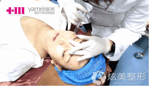 雅美玉肌术眼周治疗 雅美玉肌术眼周治疗