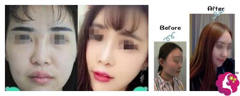 TIMͼƬ20180607094503_����.jpg