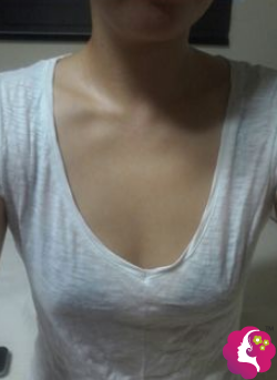 看我找重庆奥妃李华刚做假体隆胸术后1个月告别小贫乳