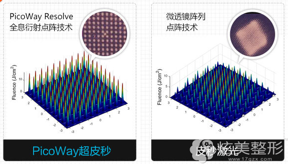 从技术对比超皮秒和皮秒 从技术对比超皮秒和皮秒