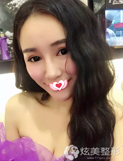 �沿�ߵ�5���Ƥ�������ۻ�