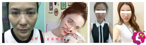 20180913112716721.png TIM图片20180913112526.png