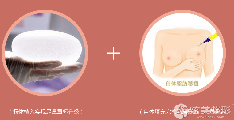 爱美尔复合式丰胸 爱美尔复合式丰胸