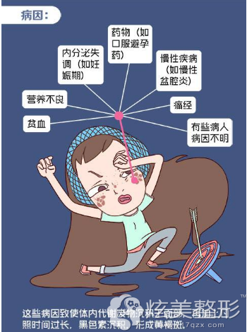 黄褐斑形成原因不同 黄褐斑形成原因不同