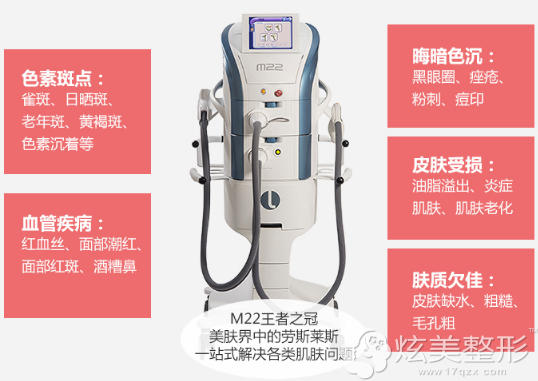 M22王者之冠材料 M22王者之冠材料
