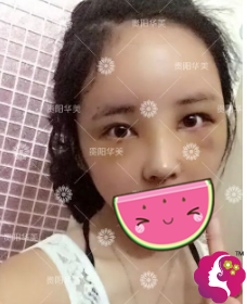 �����������ۺ�+����֬�����ṵһ�ָܻ�