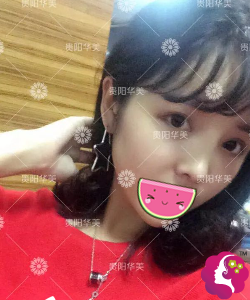 �ڹ��������ҽ�Т�������ۺ�+֬�����ṵ����ָ�