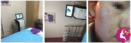 ����ҽ���״θ�����DPL��׼ȫ����߼���
