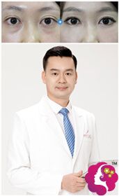 邓劲松主任超声波去眼底前后对比效果 邓劲松主任超声波去眼底前后对比效果