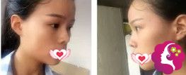 ���ٷ����������ۺ�ǰ�Ƕ�����