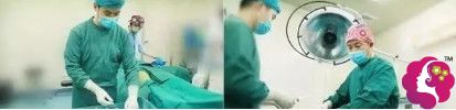艺星整形医生成浩为我做自体脂肪填充面部术中 艺星整形医生成浩为我做自体脂肪填充面部术中
