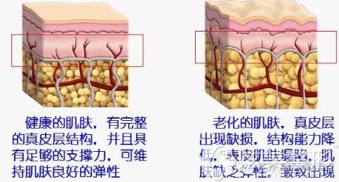 郭江花医生看线雕提拉效果 郭江花医生看线雕提拉效果