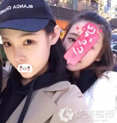 武汉美基元隆鼻两个月的时候 武汉美基元隆鼻两个月的时候